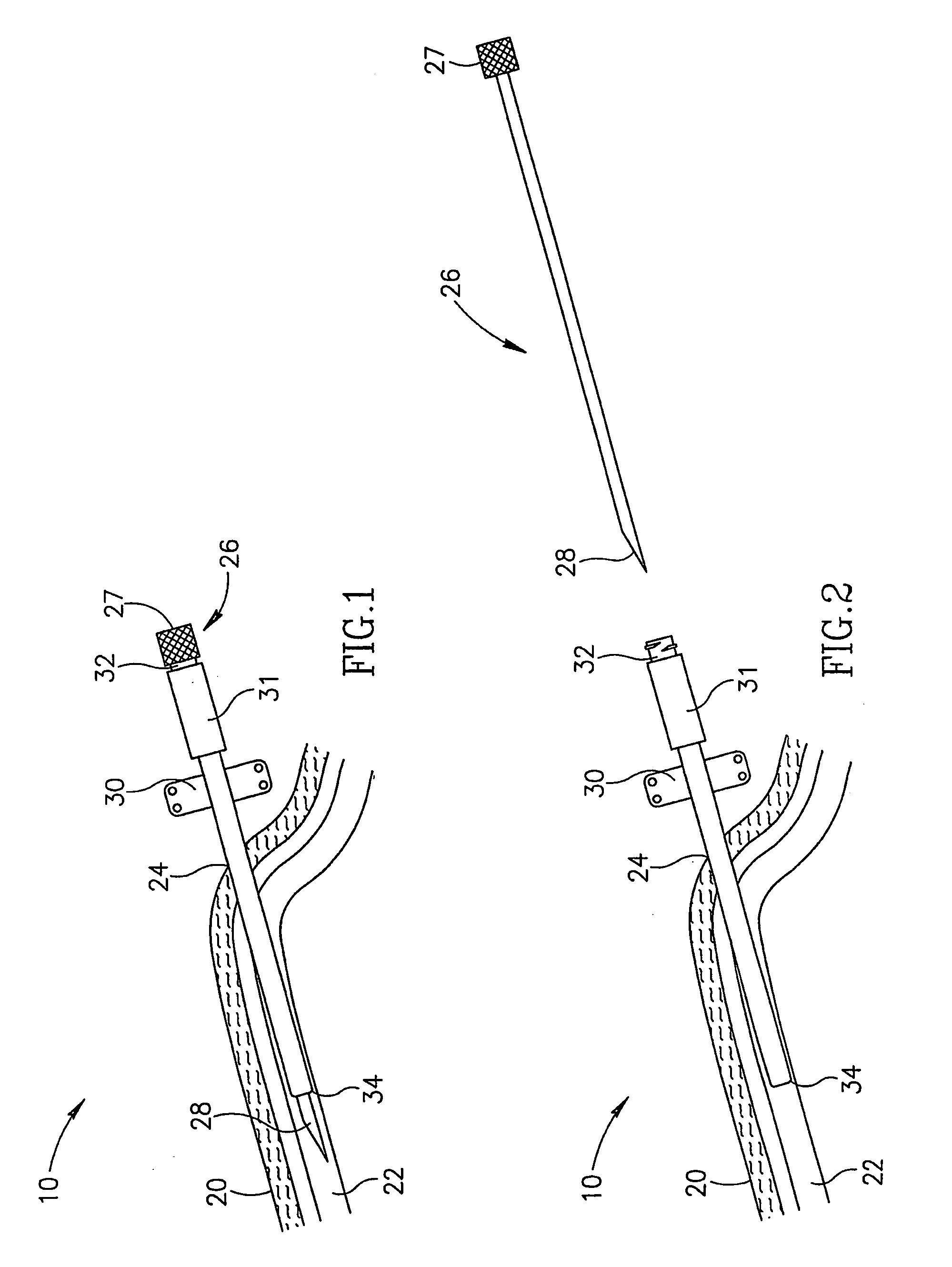 Intravenous catheter assembly