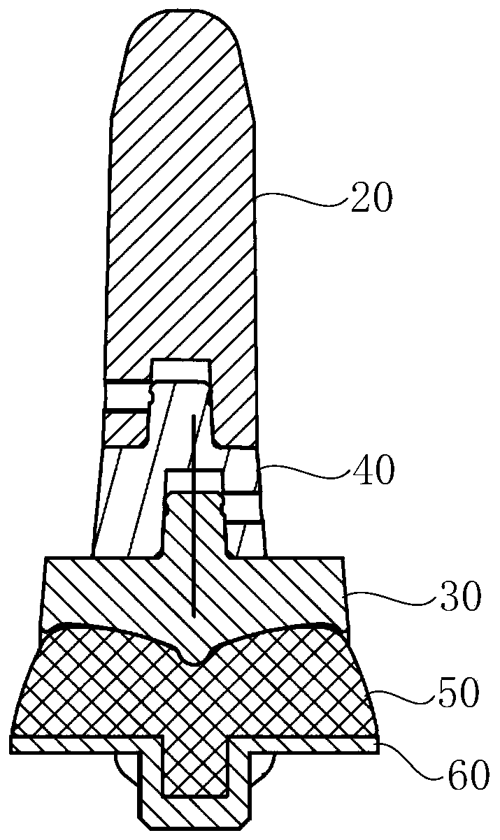 Ankle joint prosthesis