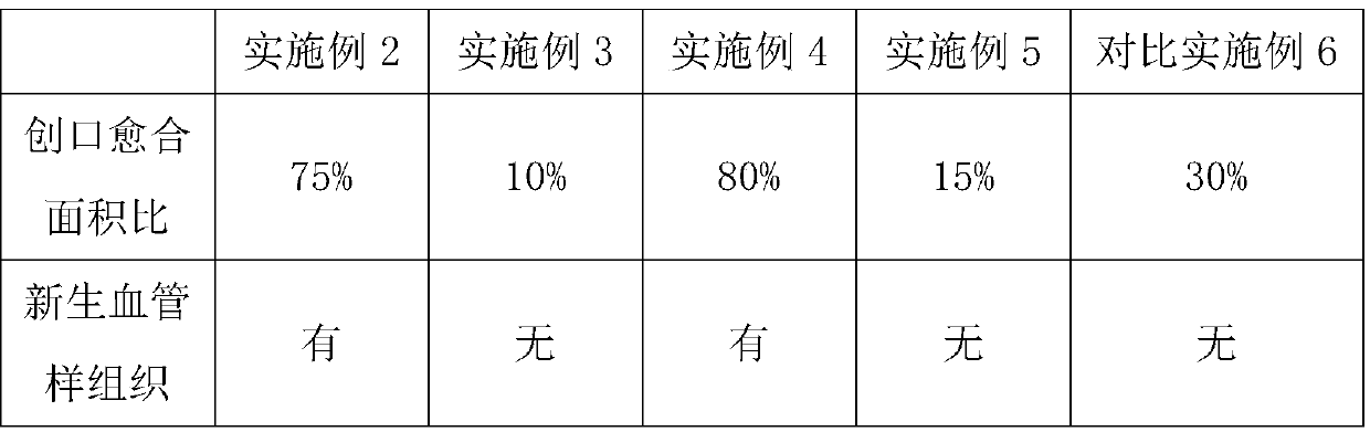 Platelet directional-release growth factor composition and preparation method thereof