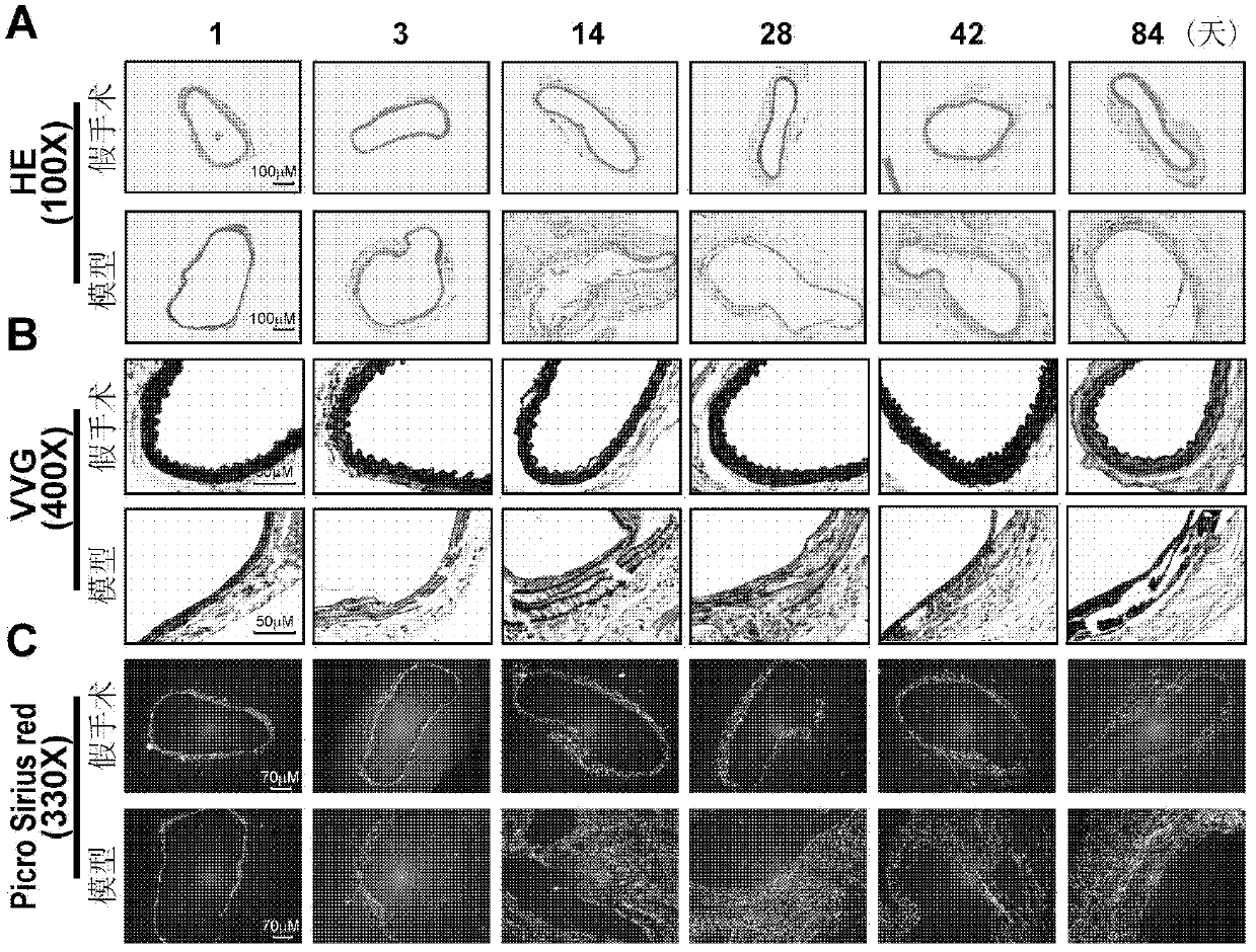 Use of ag490 in prevention and treatment of abdominal aortic aneurysm