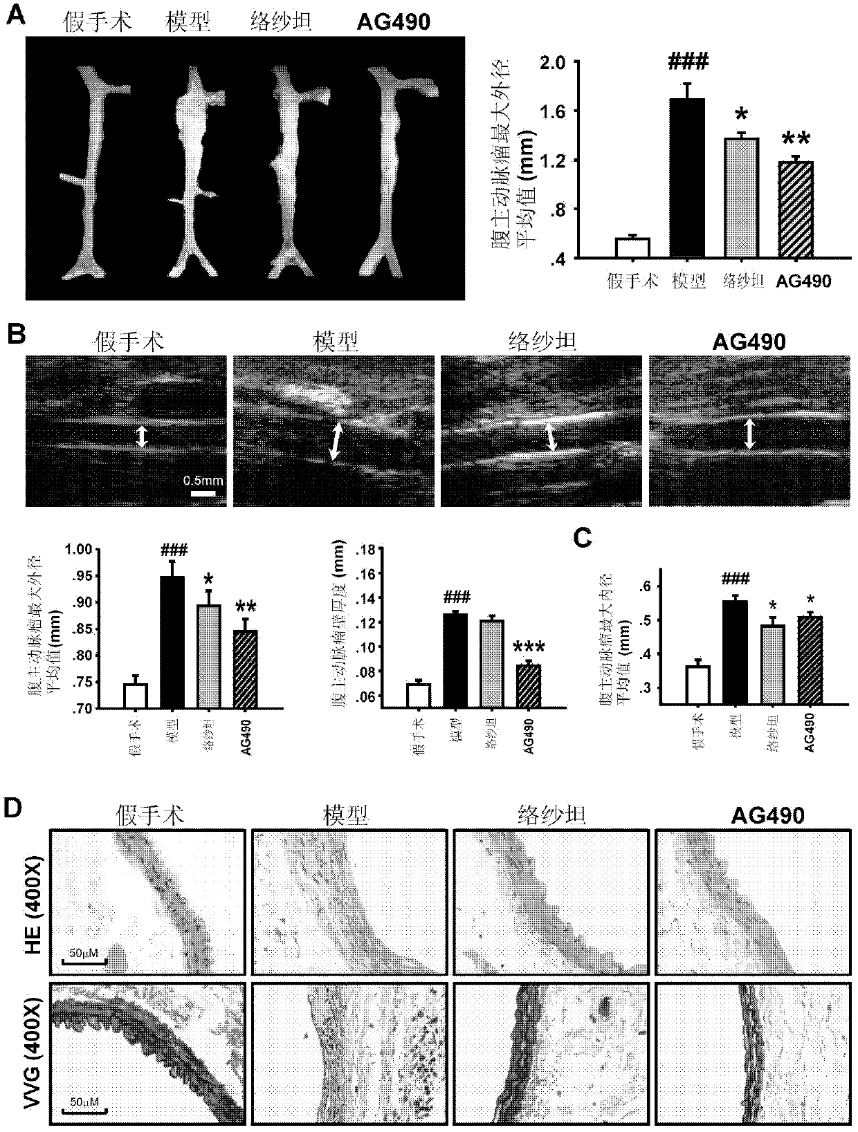 Use of ag490 in prevention and treatment of abdominal aortic aneurysm