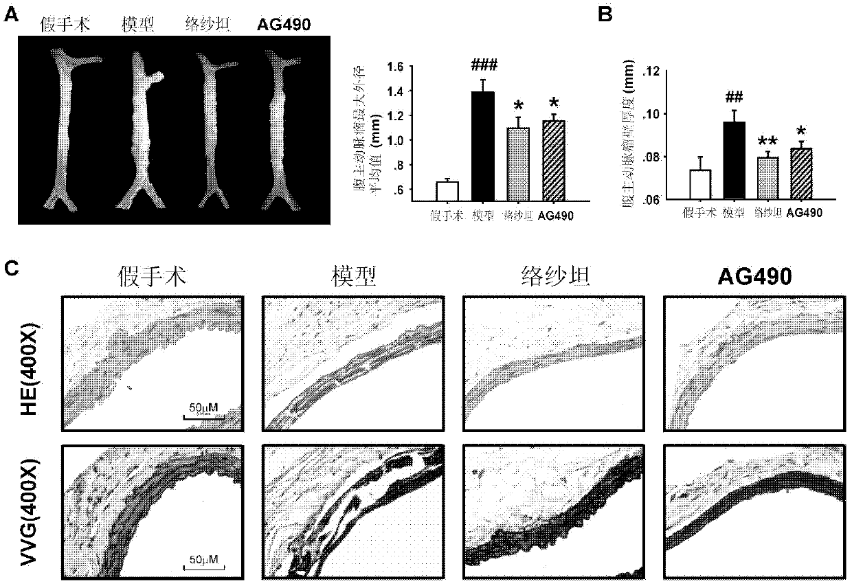 Use of ag490 in prevention and treatment of abdominal aortic aneurysm