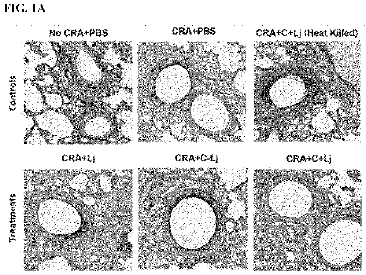 Compositions for treating inflammation and uses thereof