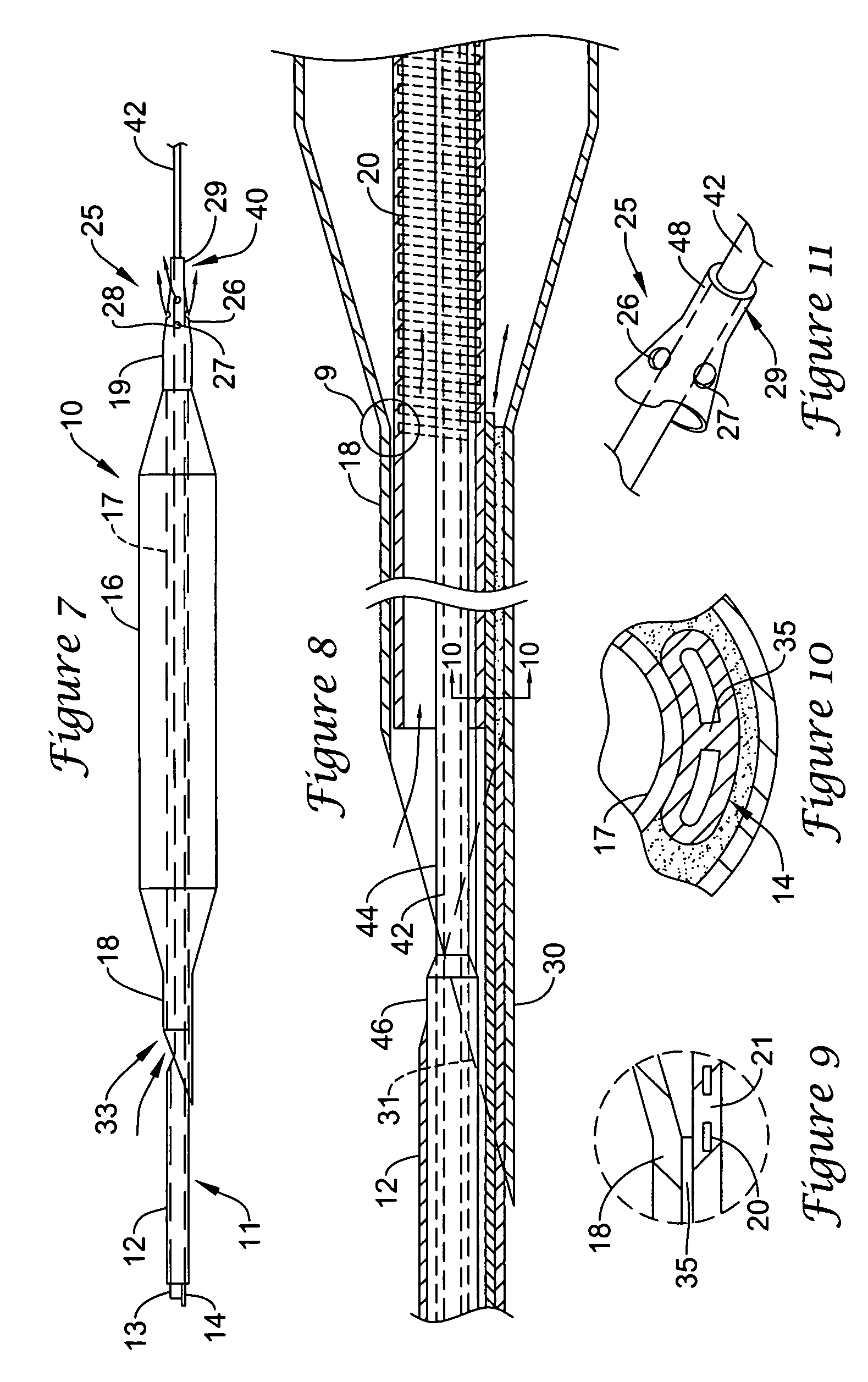 Perfusion balloon angioplasty catheter