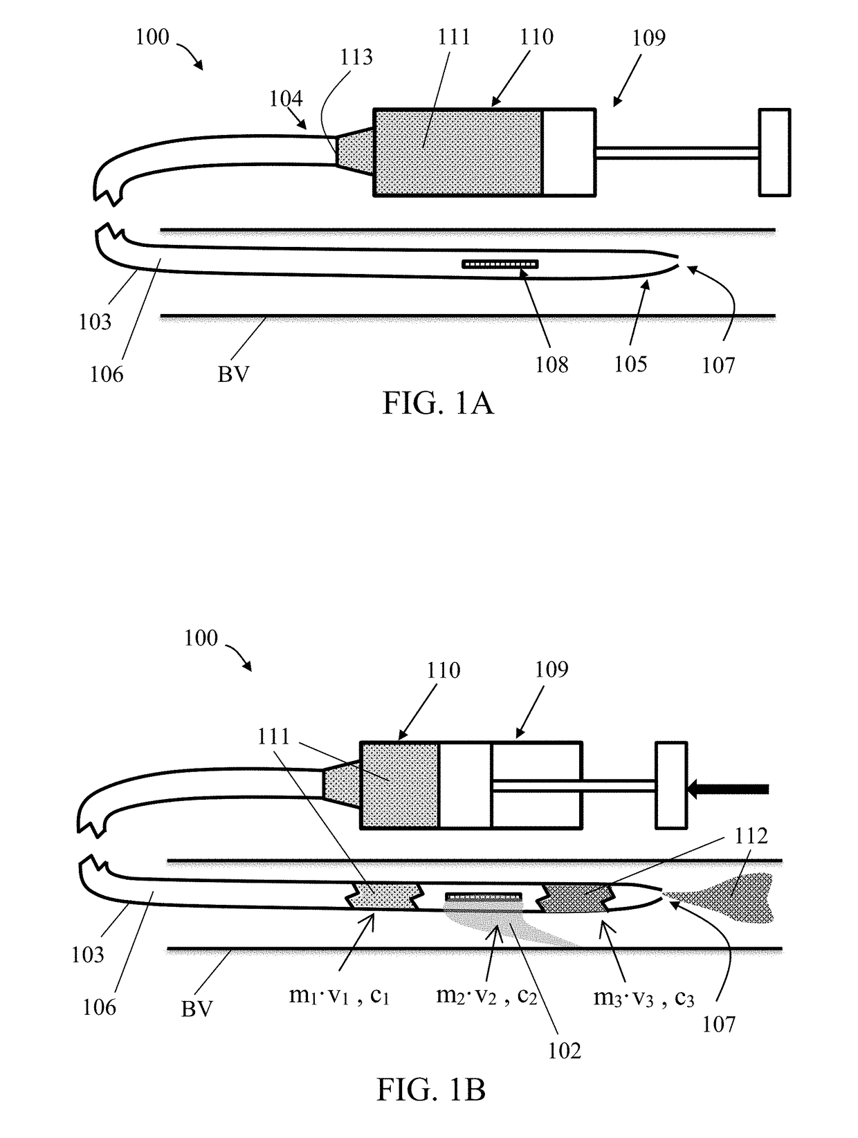 Catheters with side openings for modifying and delivering suspensions to a subject