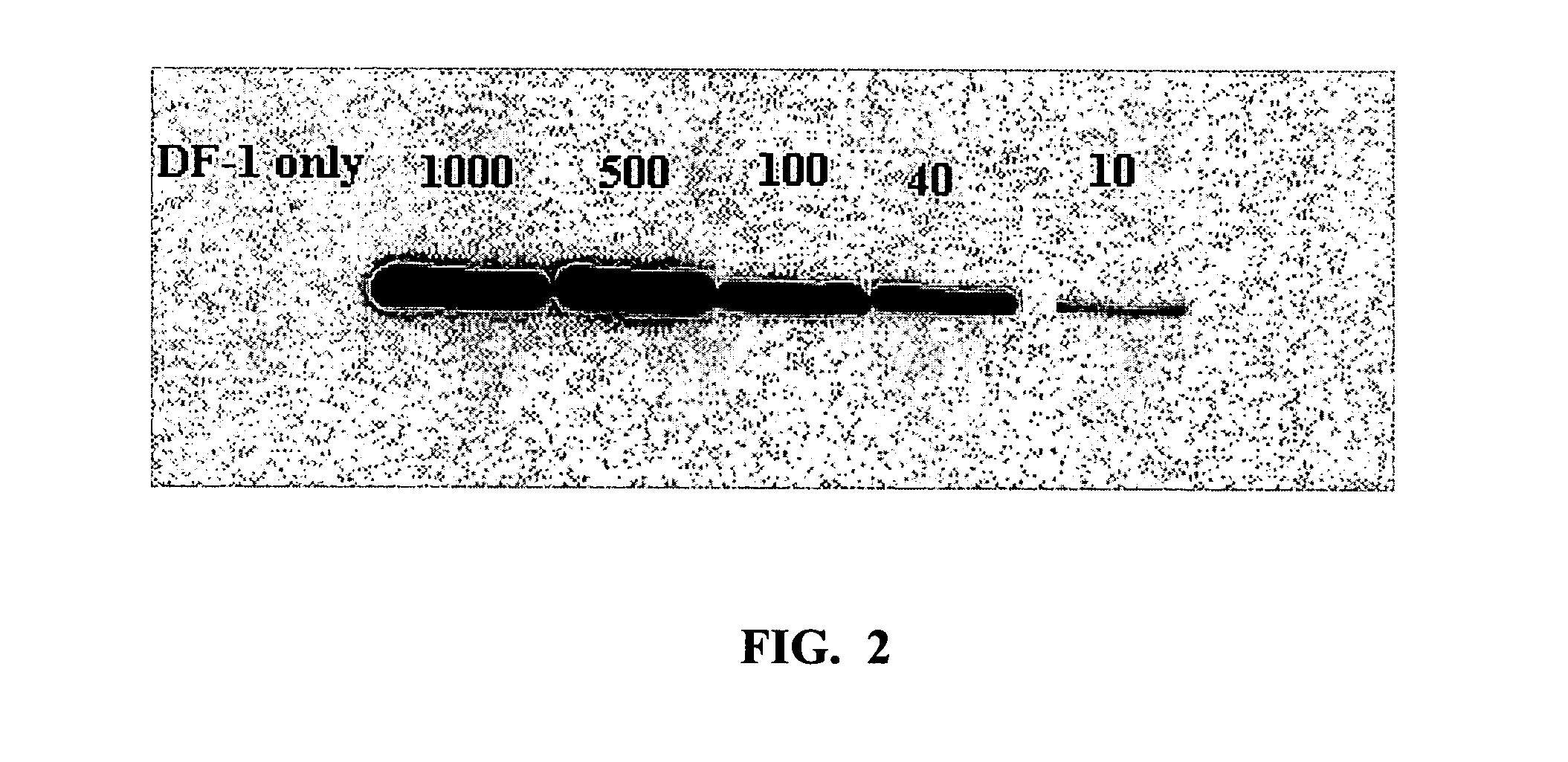 Methods and compositions related to 1-caldesmon