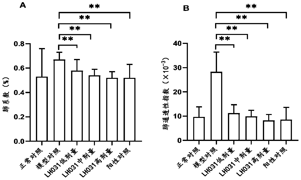 Application of compound to preparation of medicament for treating acute lung injury