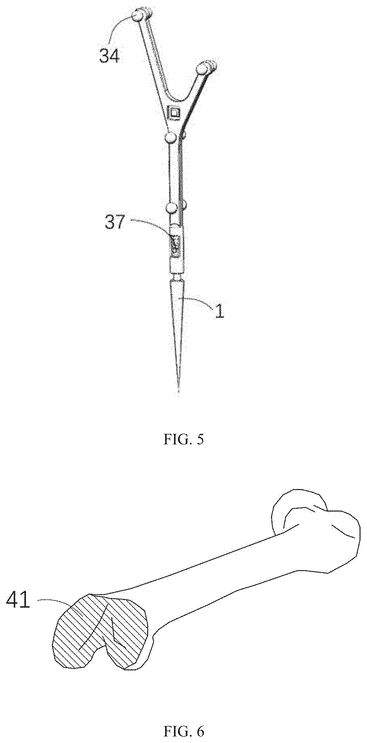 Method, system for registration of bone, and trackable element