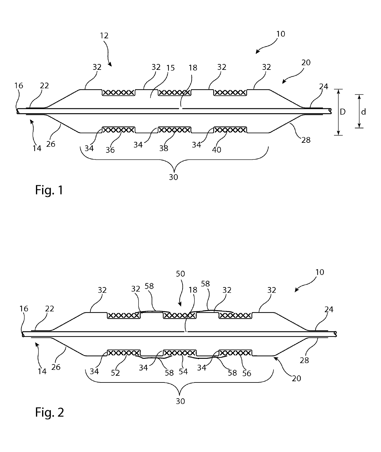 Delivery system for implantable medical device