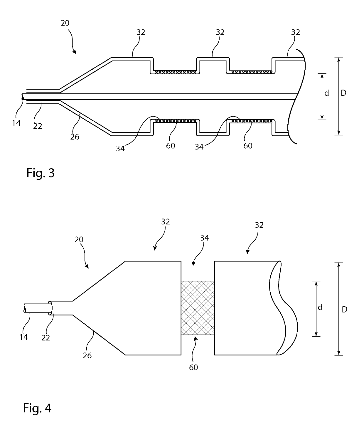 Delivery system for implantable medical device