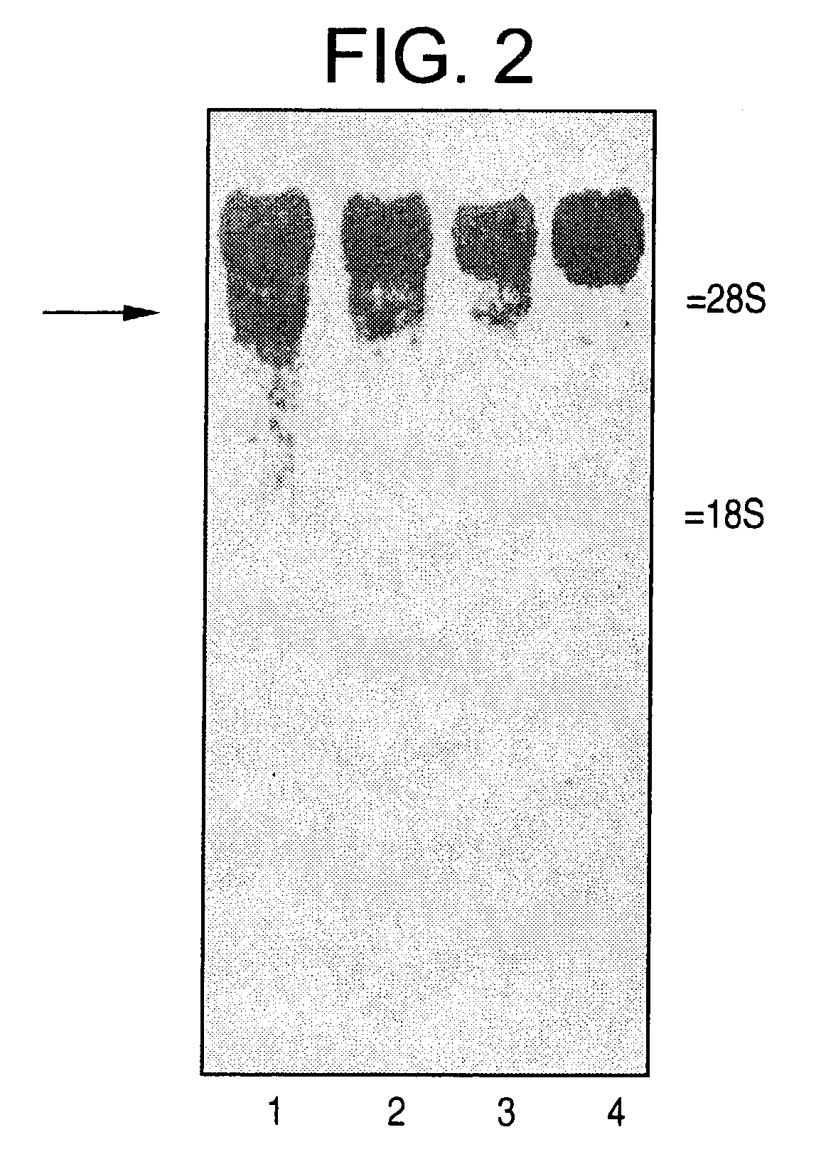 Methods using agonist antibodies to CNS neurite outgrowth modulators