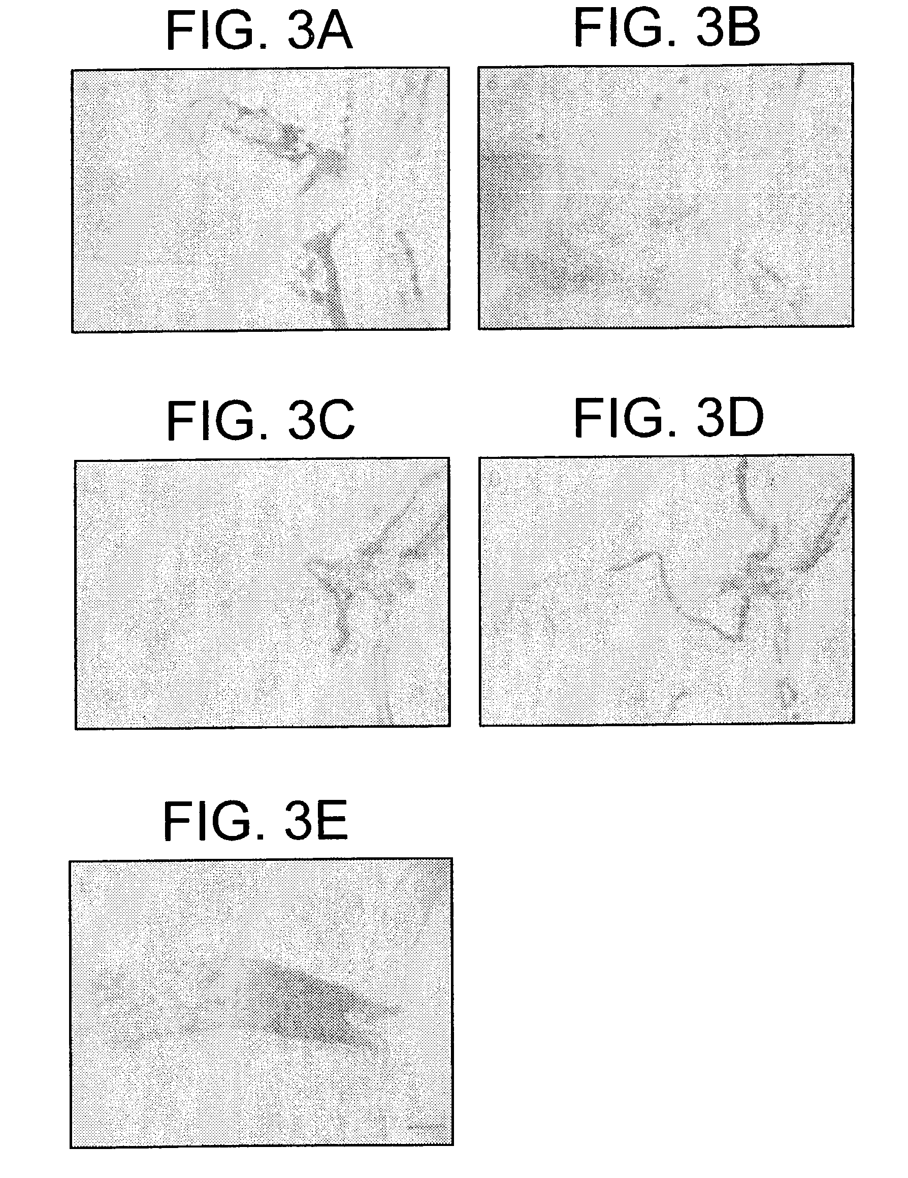 Methods using agonist antibodies to CNS neurite outgrowth modulators