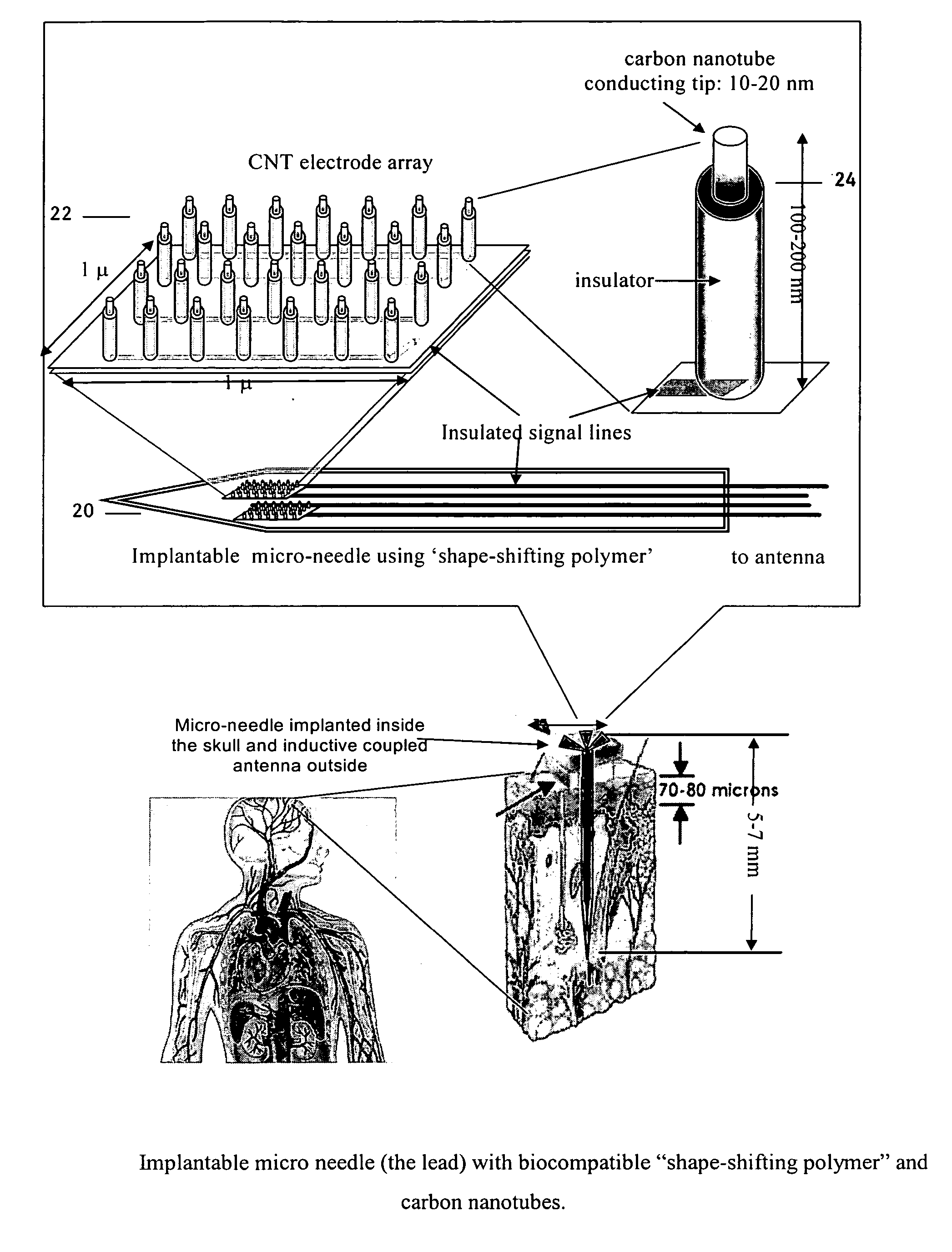 Method and device for treatment of medical conditions and monitoring physical movements