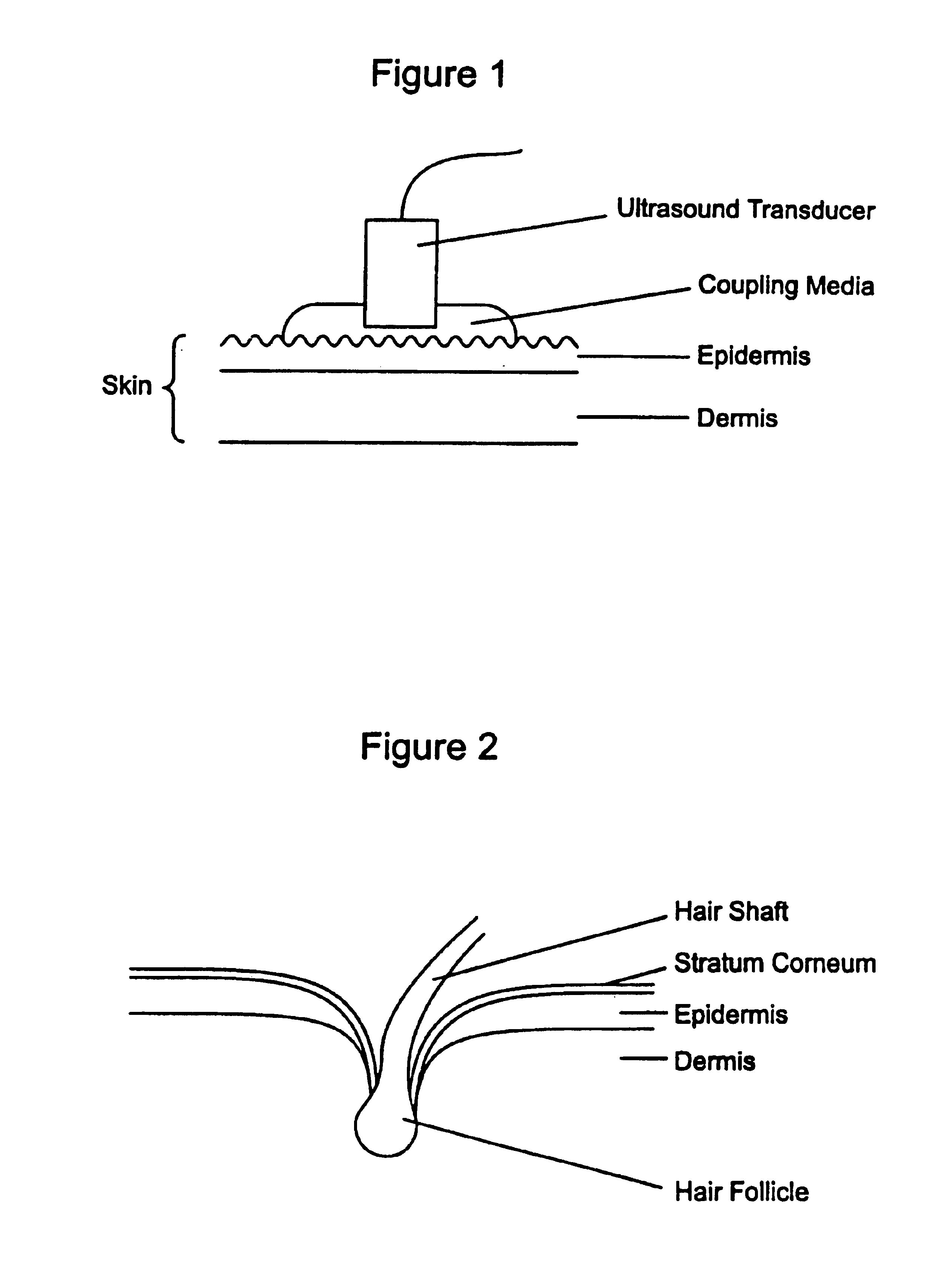 Ultrasound enhancement of percutaneous drug absorption