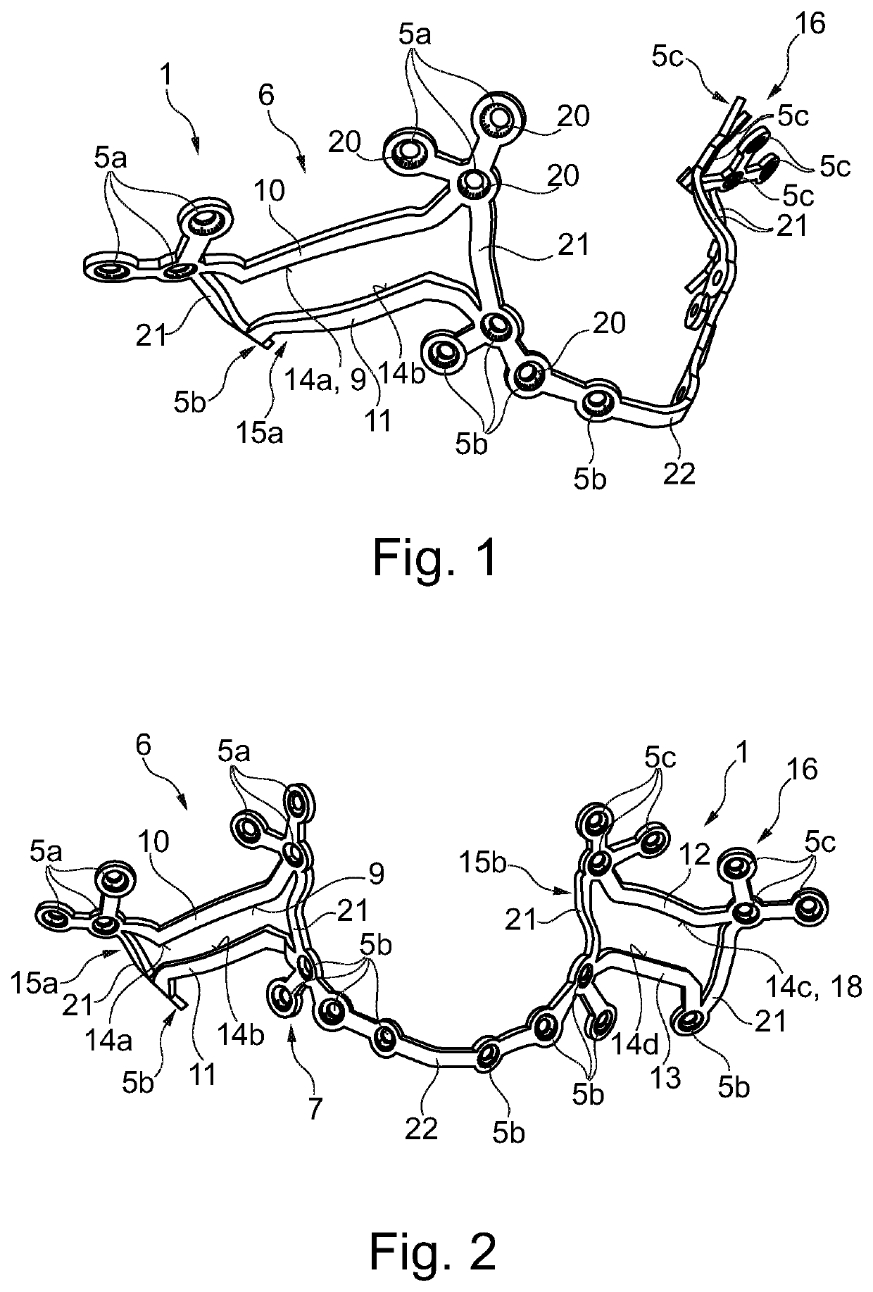 Orthognathic saw and positioning implant