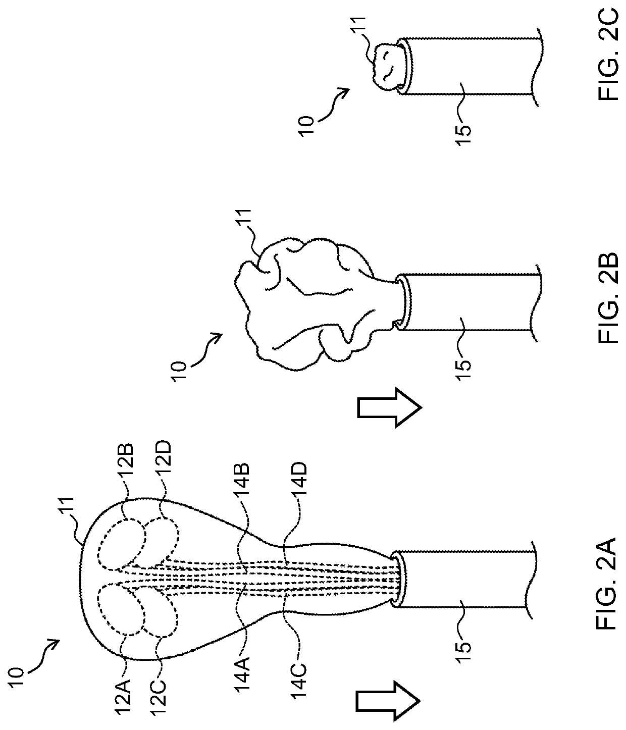 Cardiac output support apparatus