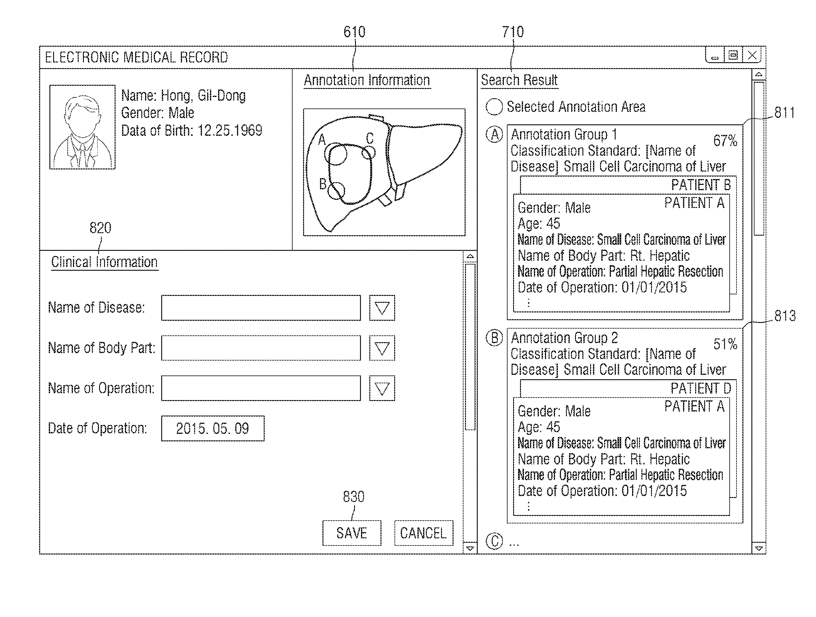 Method and apparatus for managing medical metadatabase