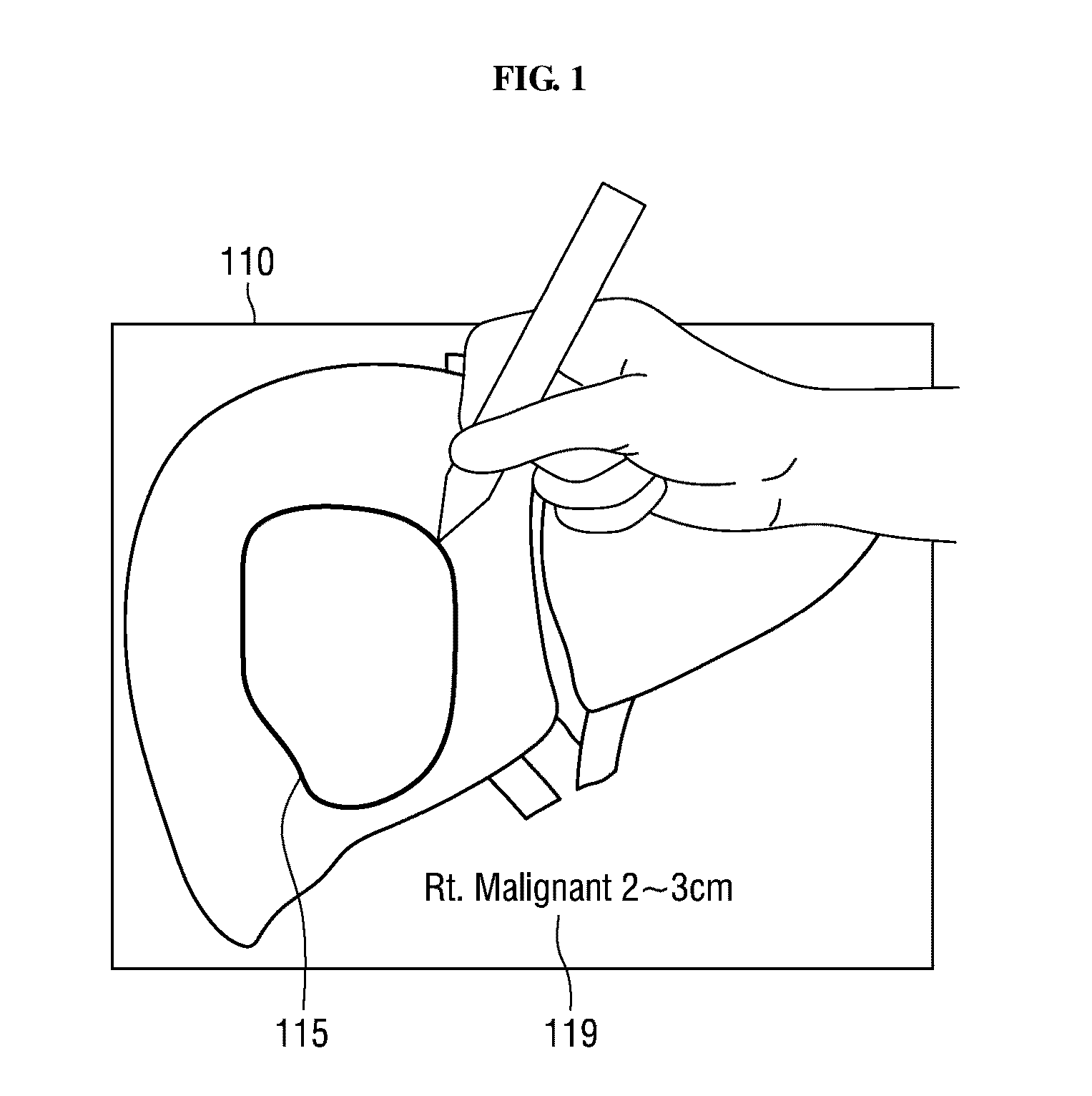 Method and apparatus for managing medical metadatabase