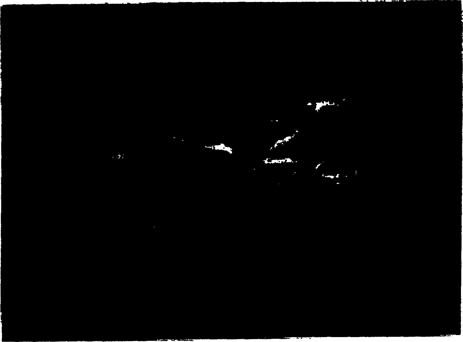 Preparation method of medicine elution type blood vessel stent