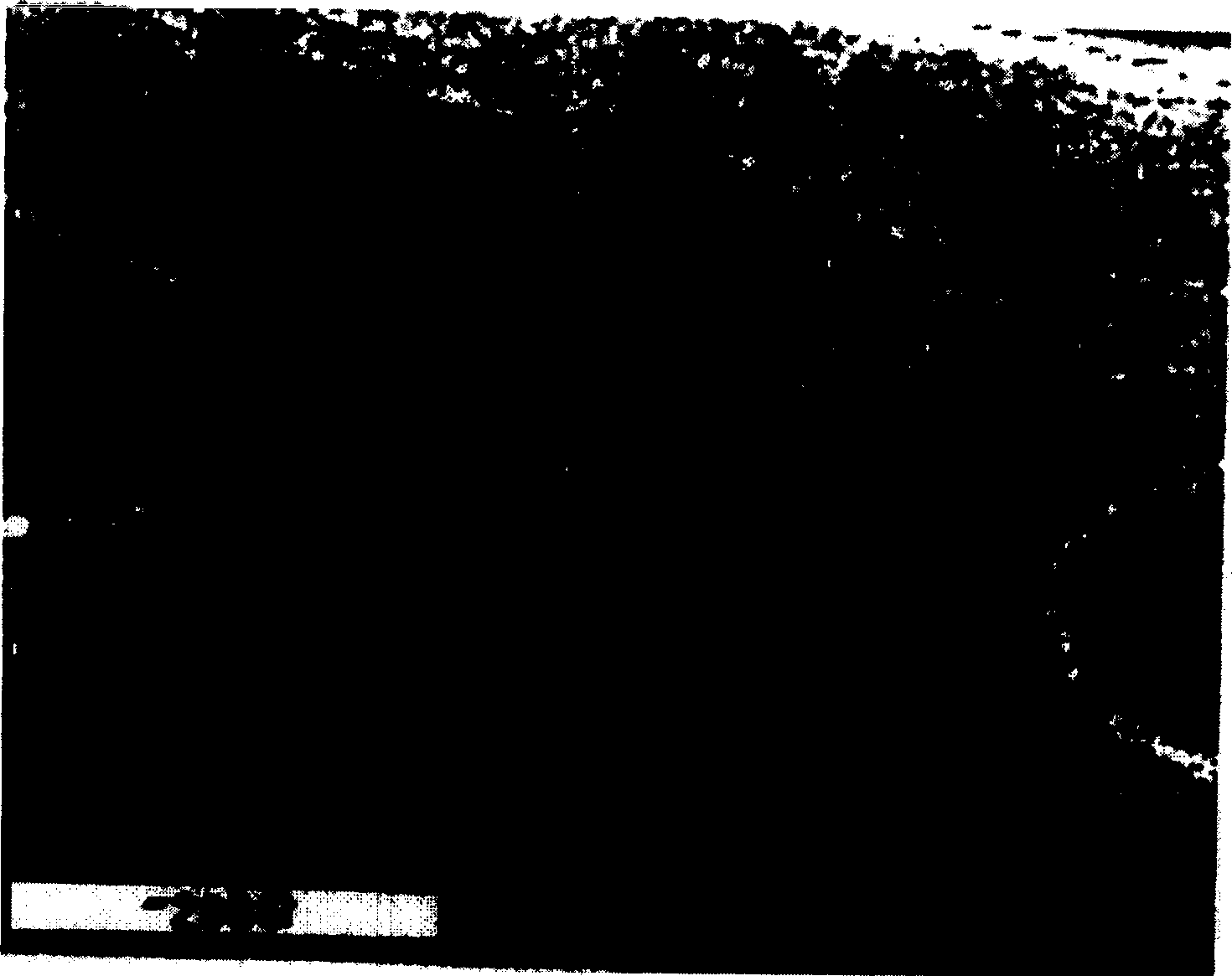 Preparation method of medicine elution type blood vessel stent