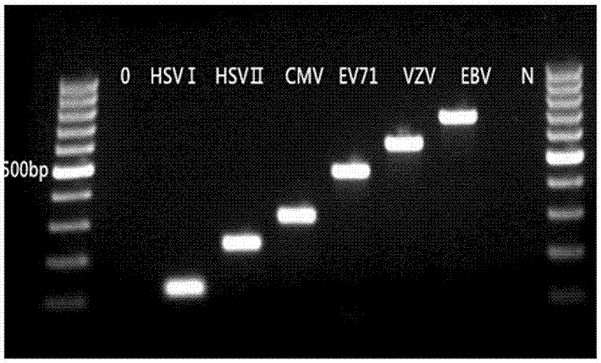 Multiplex-PCR kit for rapid diagnosis of viral encephalitis