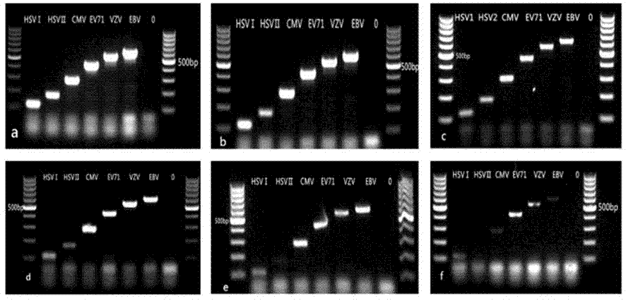 Multiplex-PCR kit for rapid diagnosis of viral encephalitis