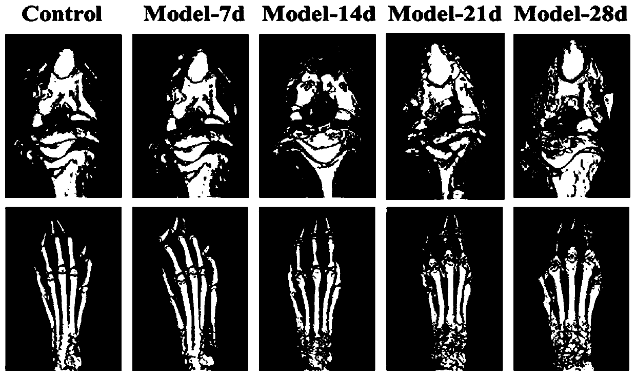 Diagnostic marker of bone destructive disease and application of diagnostic marker