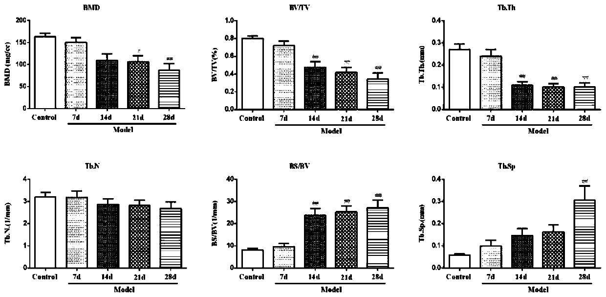 Diagnostic marker of bone destructive disease and application of diagnostic marker