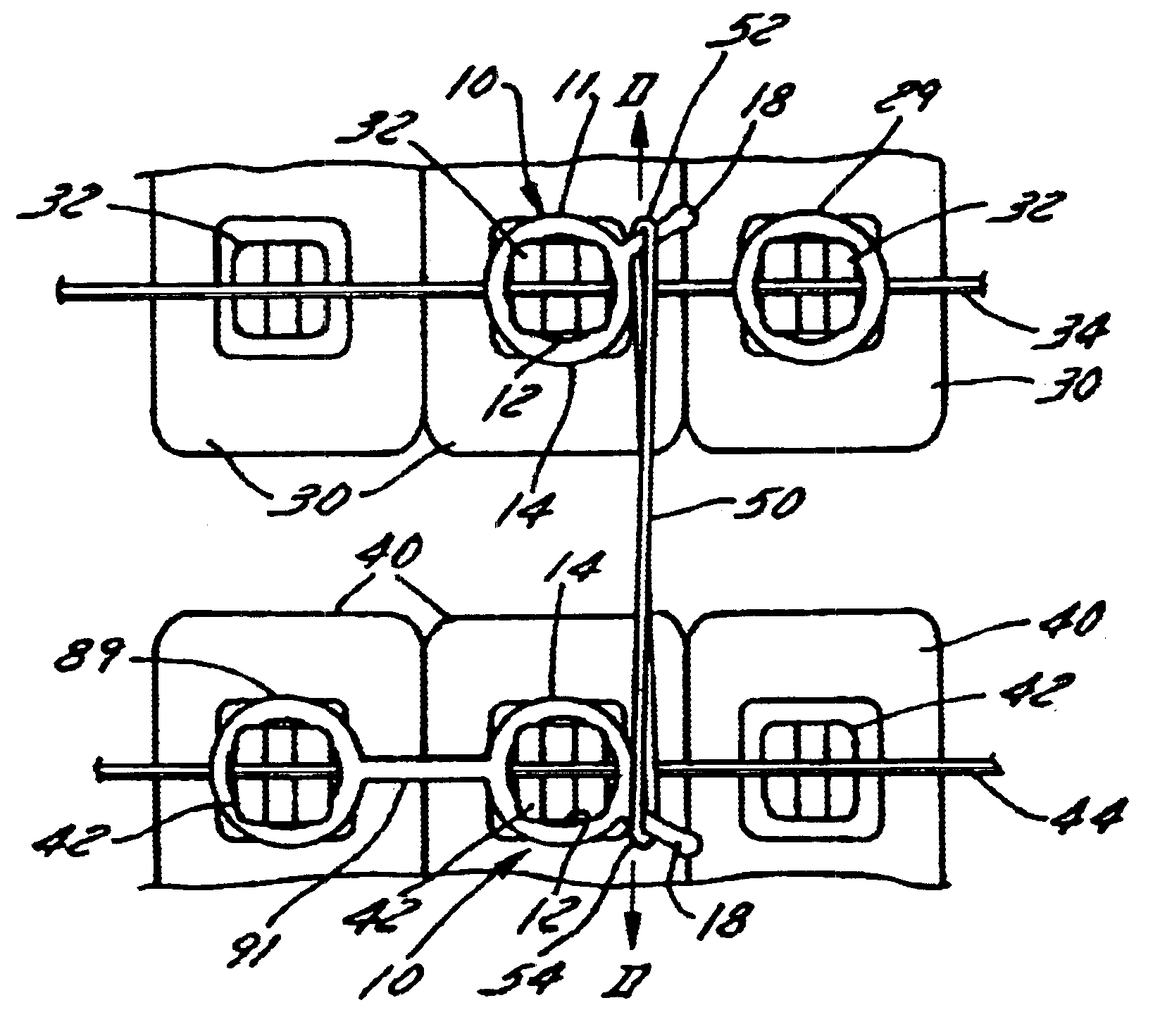 Orthodontic ligature and method of use