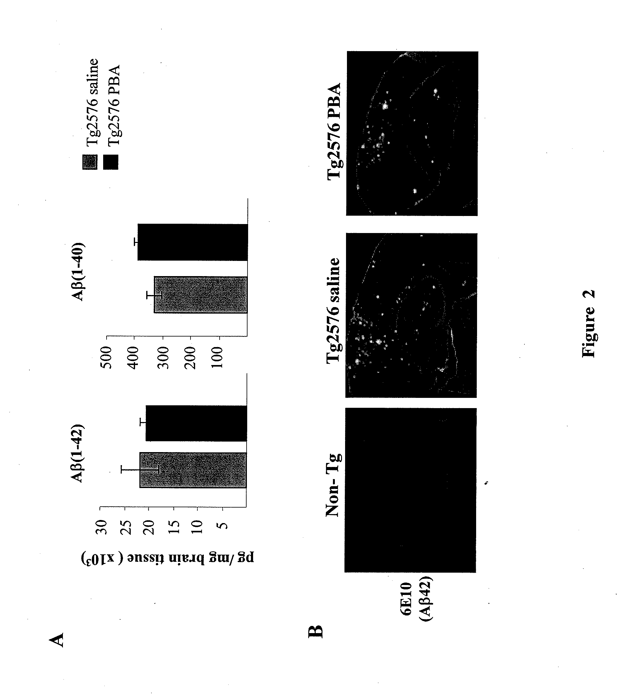 Novel uses for 4-phenylbutyrate (4PBA) and its pharmaceutically acceptable salts