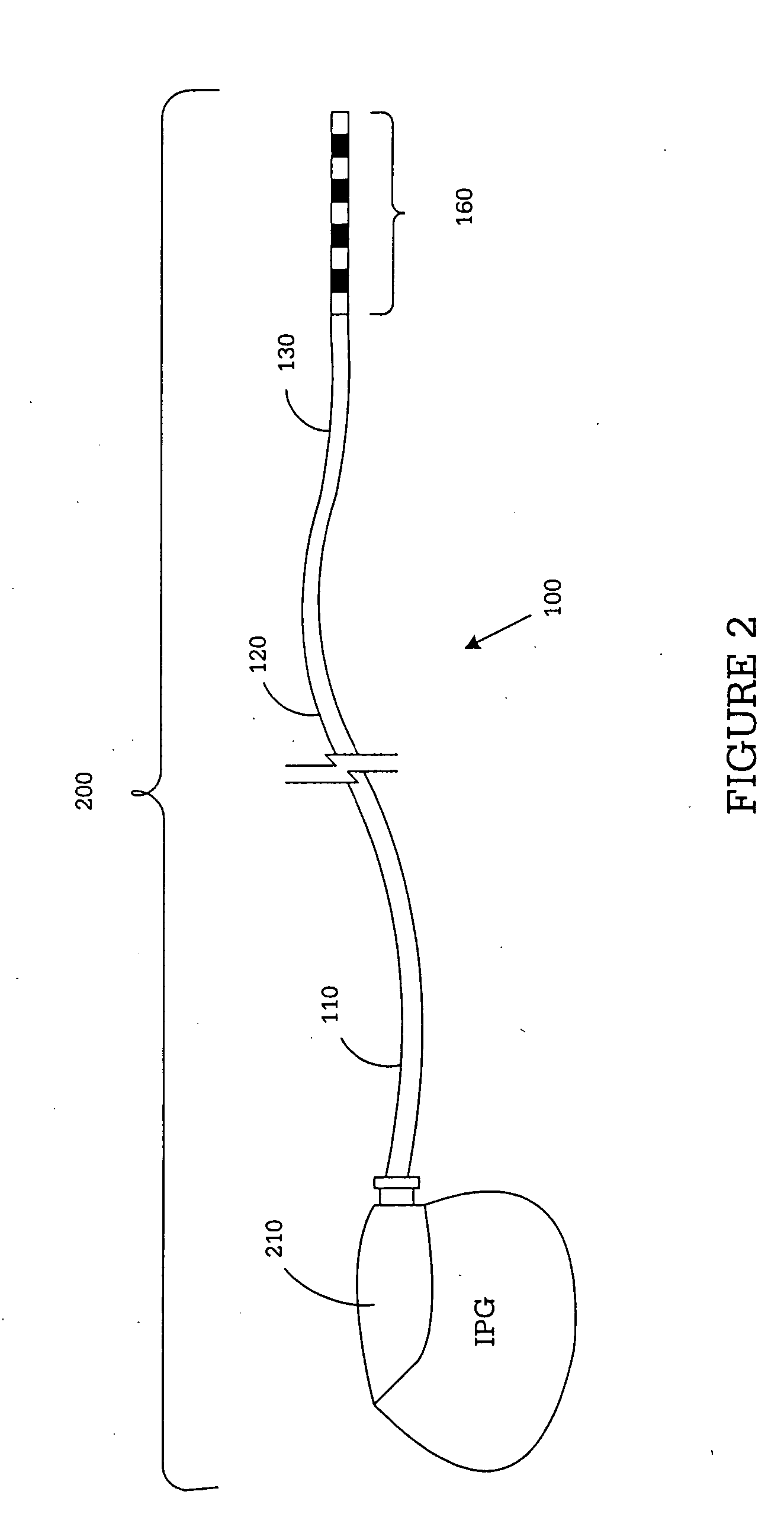 System and method for providing a medical lead body