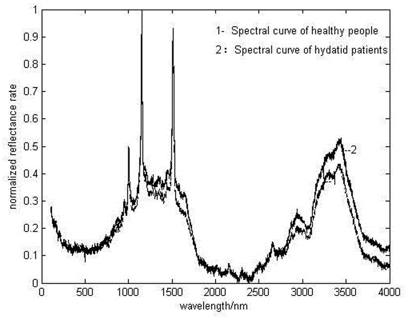 Echinococcosis patient serum spectral recognition method based on principal component analysis and BP neural network