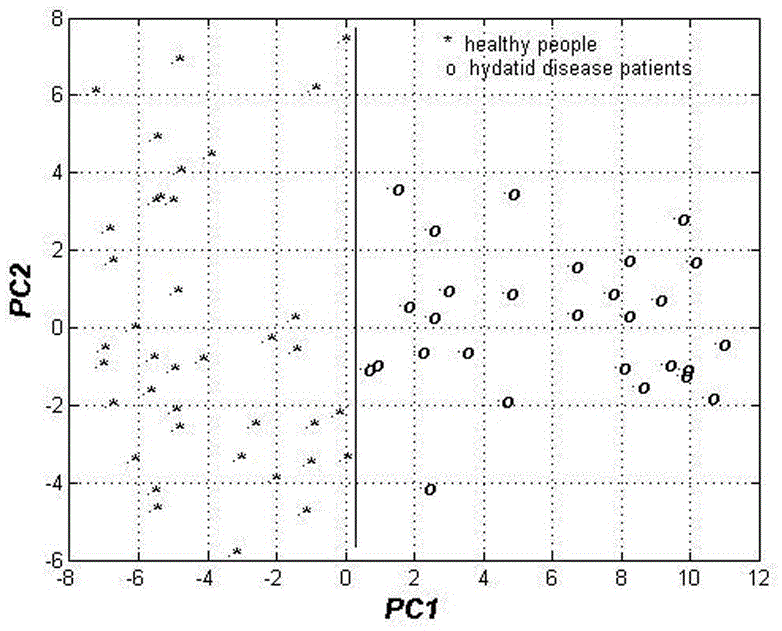 Echinococcosis patient serum spectral recognition method based on principal component analysis and BP neural network