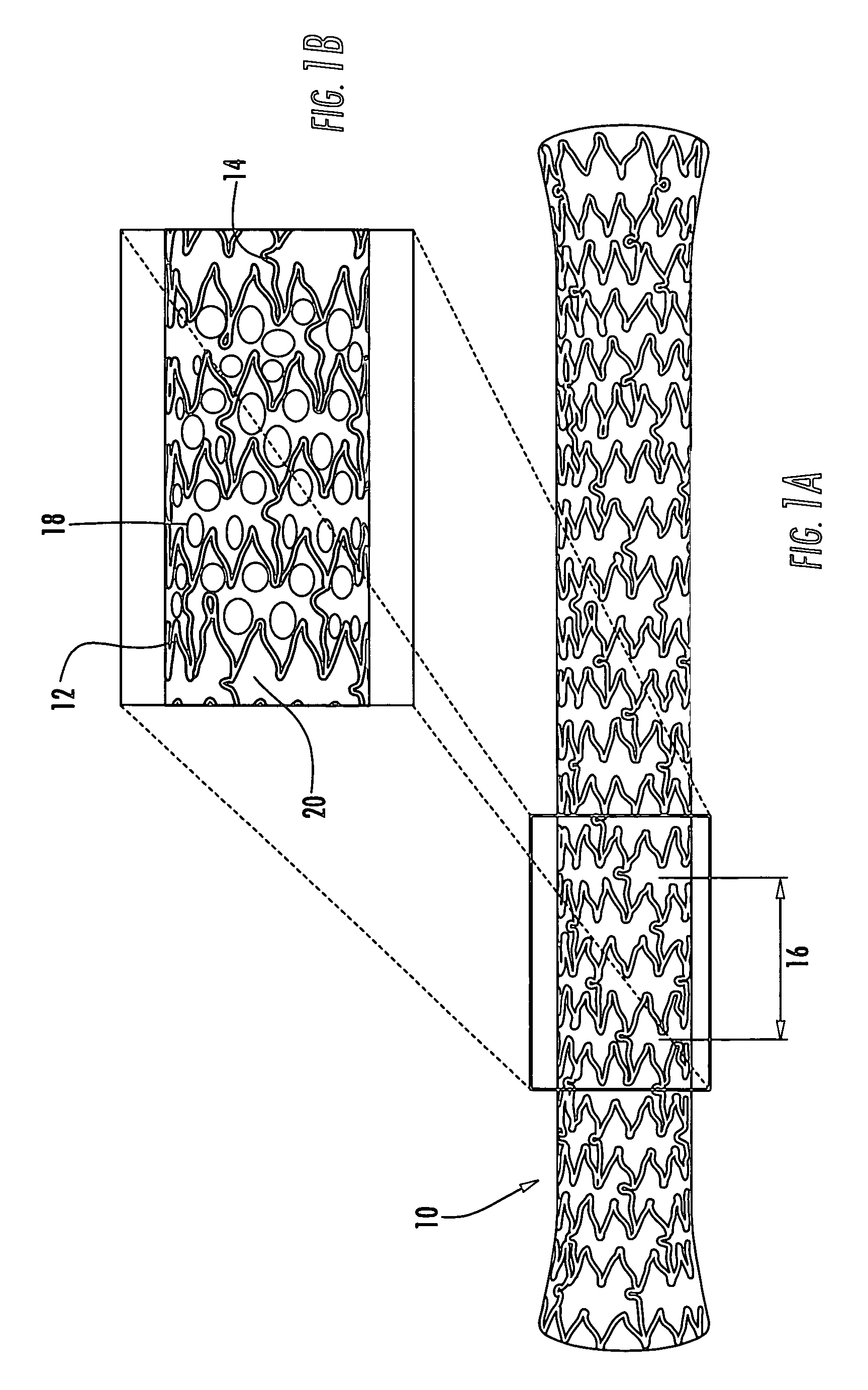 Drainage stent and associated method