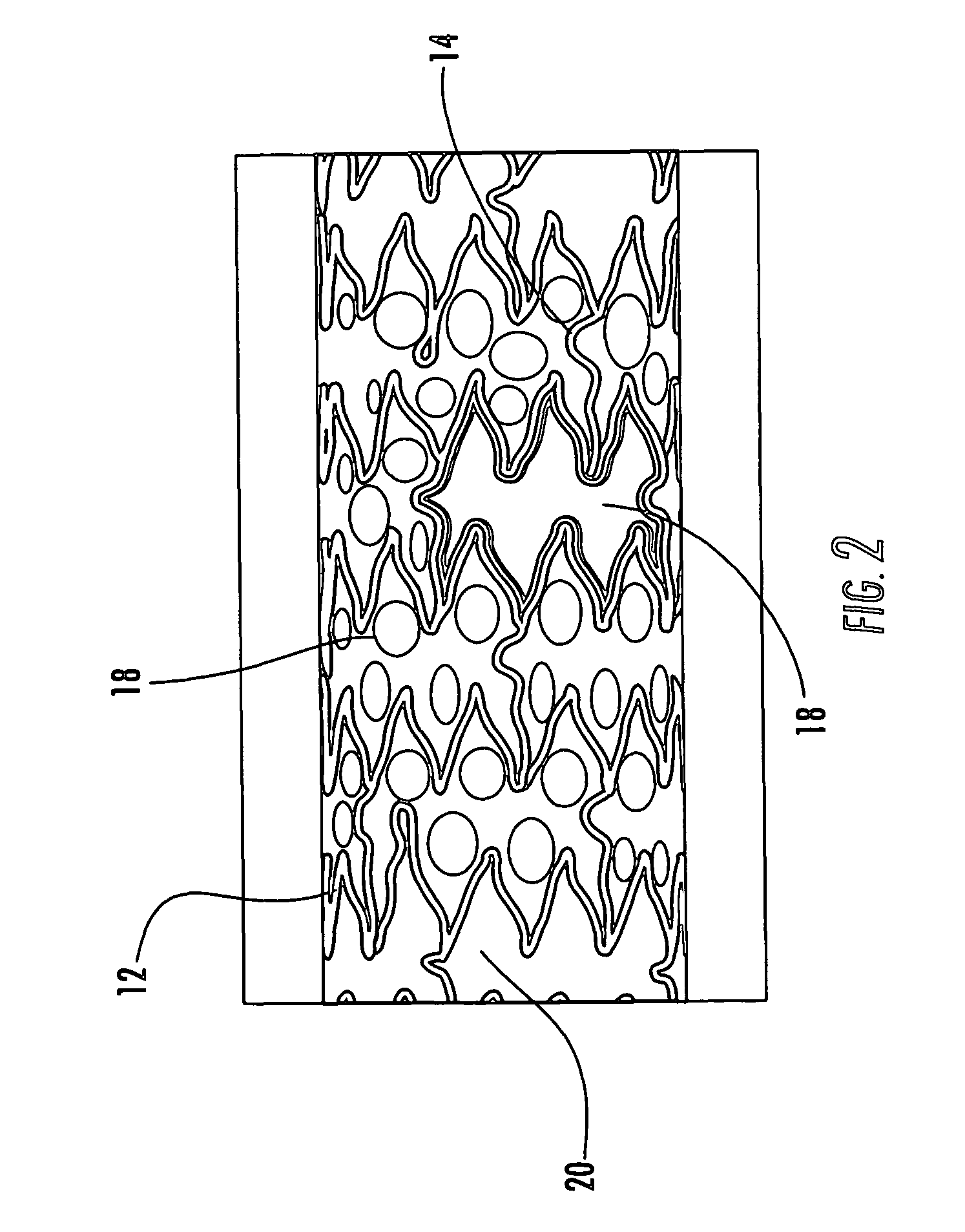 Drainage stent and associated method