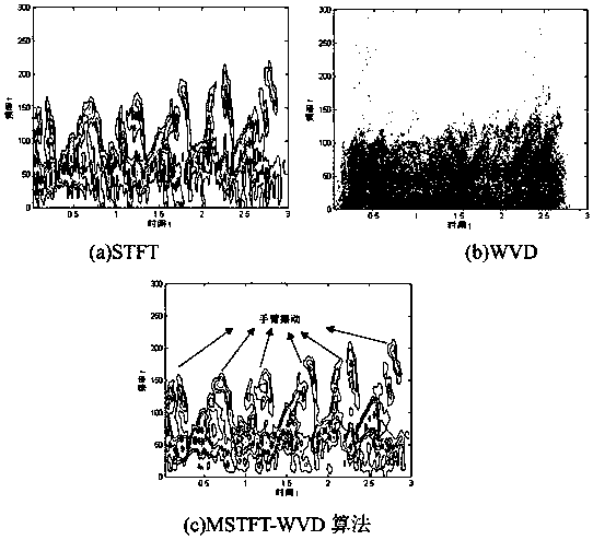 Radar target recognition method based on micro-Doppler feature extraction and deep learning