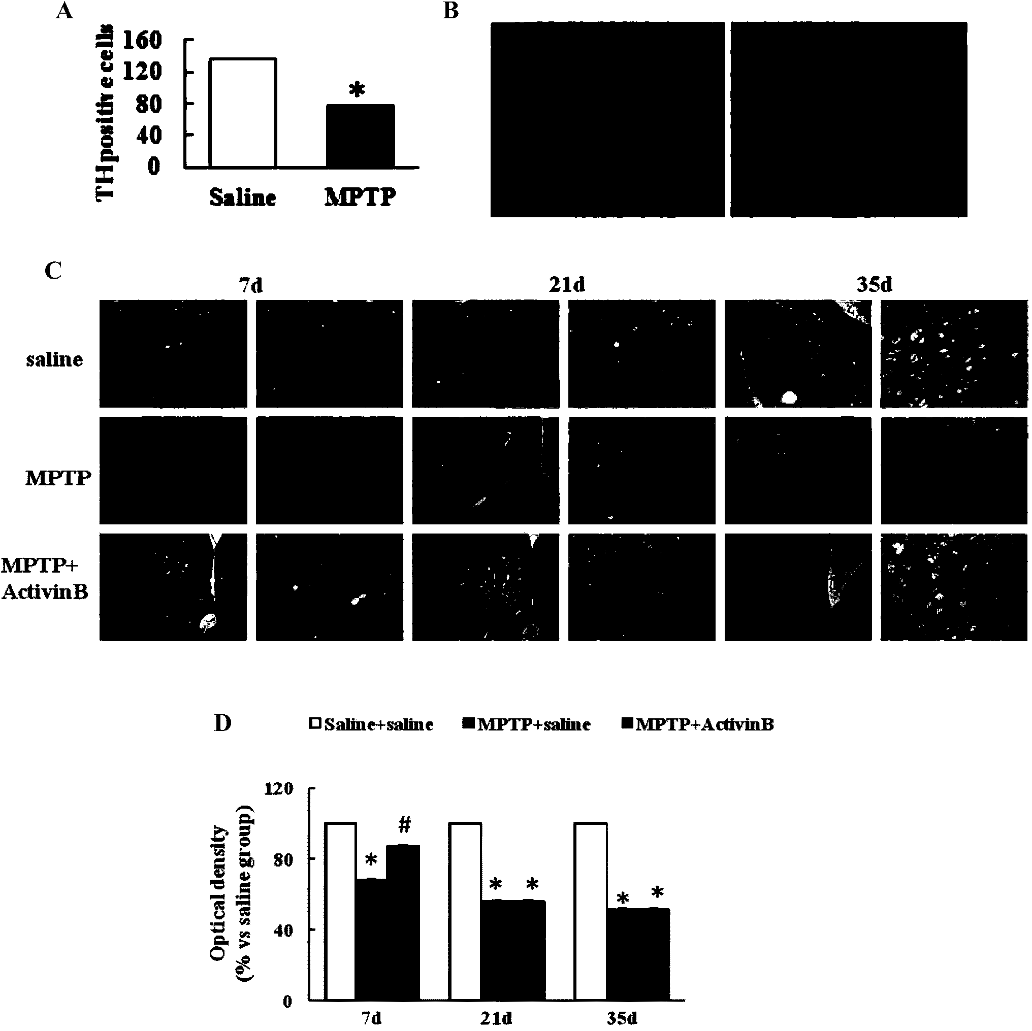 Application of Activin B in preparation of medicine for treating neurodegeneration diseases