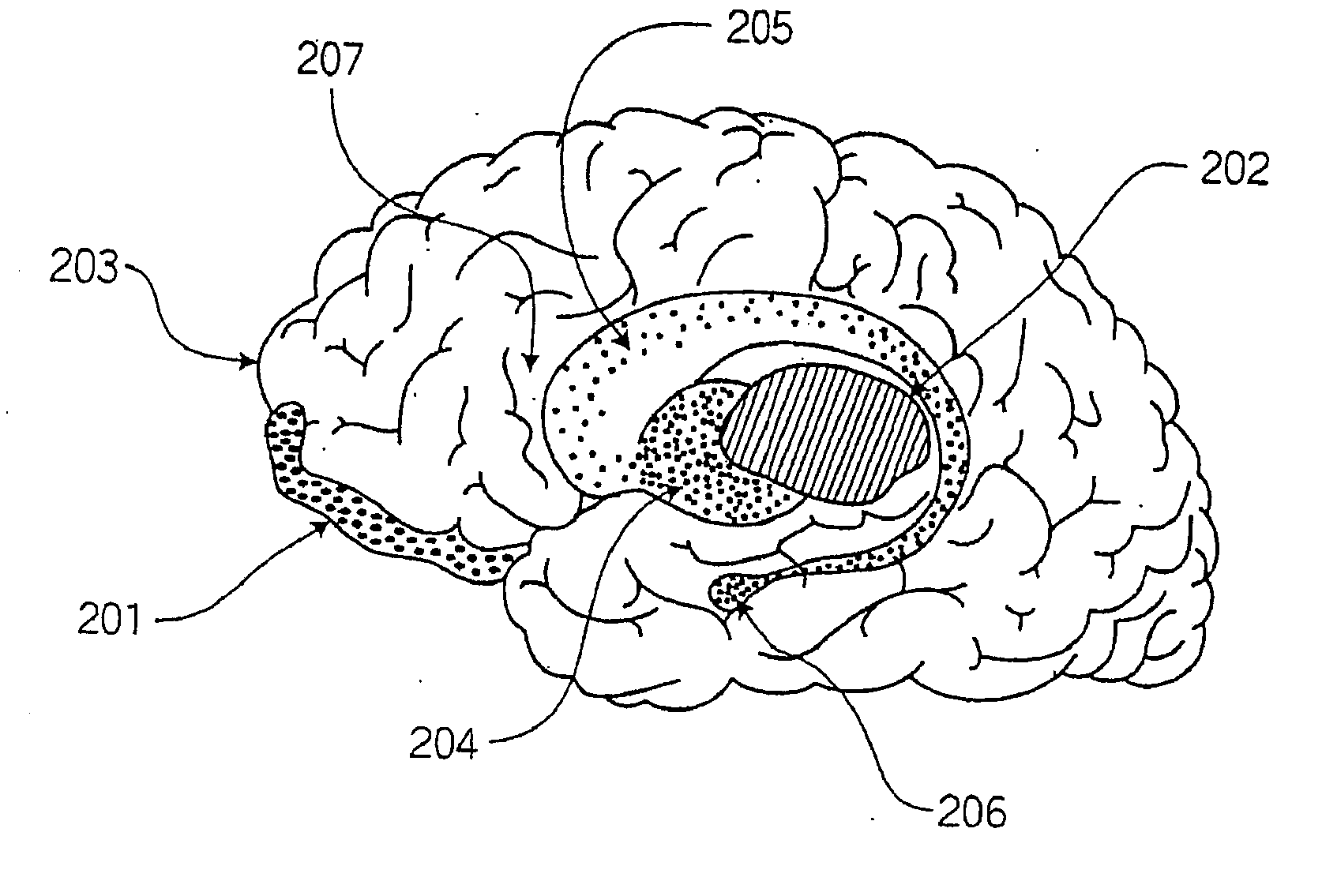 Modulation of the Brain to Affect Psychiatric Disorders and Functions