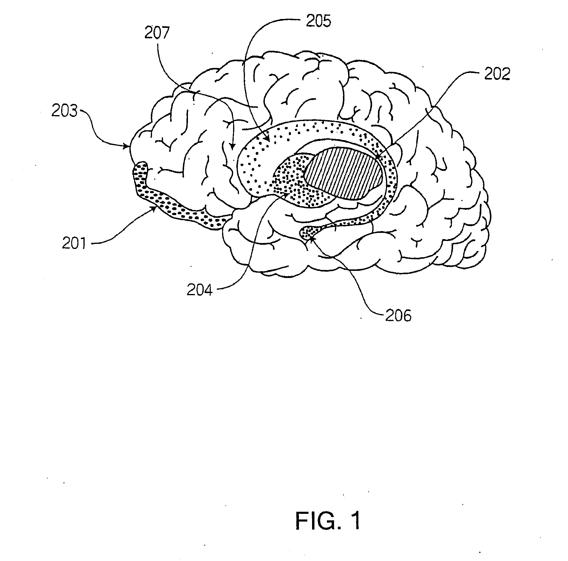 Modulation of the Brain to Affect Psychiatric Disorders and Functions