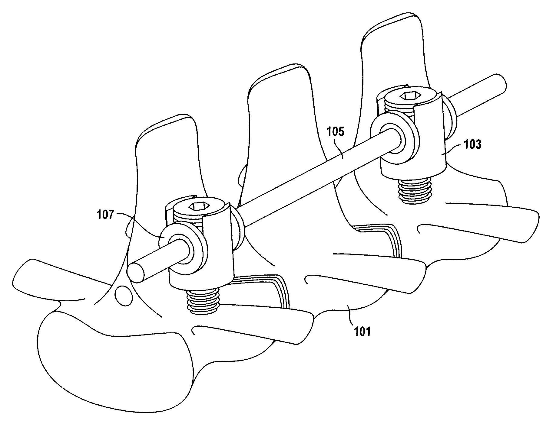 Dynamic spinal deformity correction