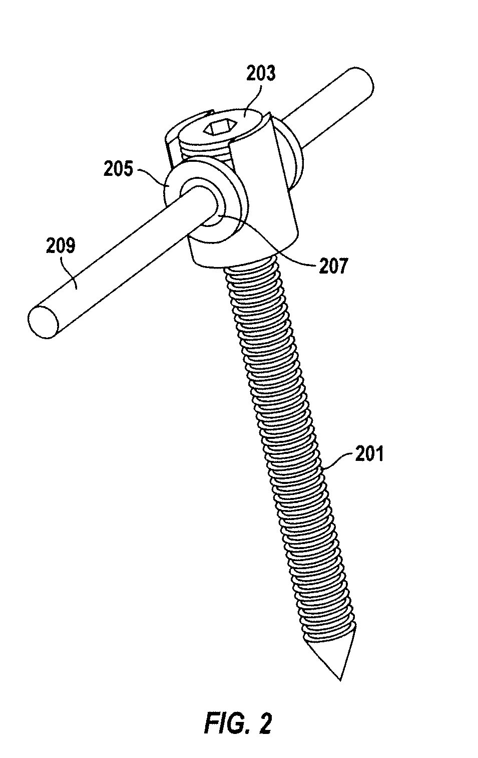 Dynamic spinal deformity correction