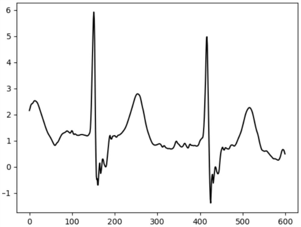 Convolutional neural network-extremely randomized trees (CNN-ET) model-based electrocardiogram monitoring method