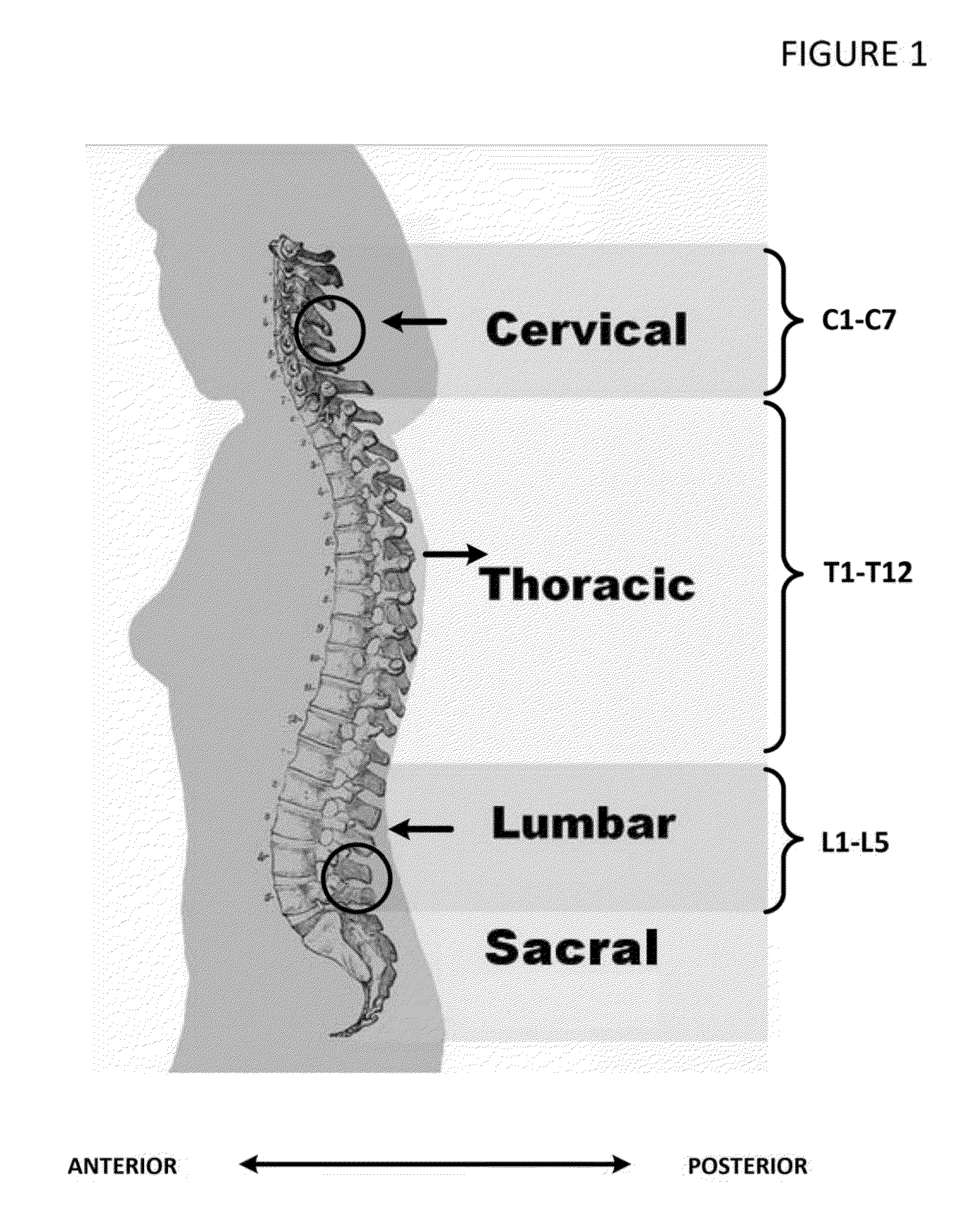 System and method of biomechanical posture detection and feedback