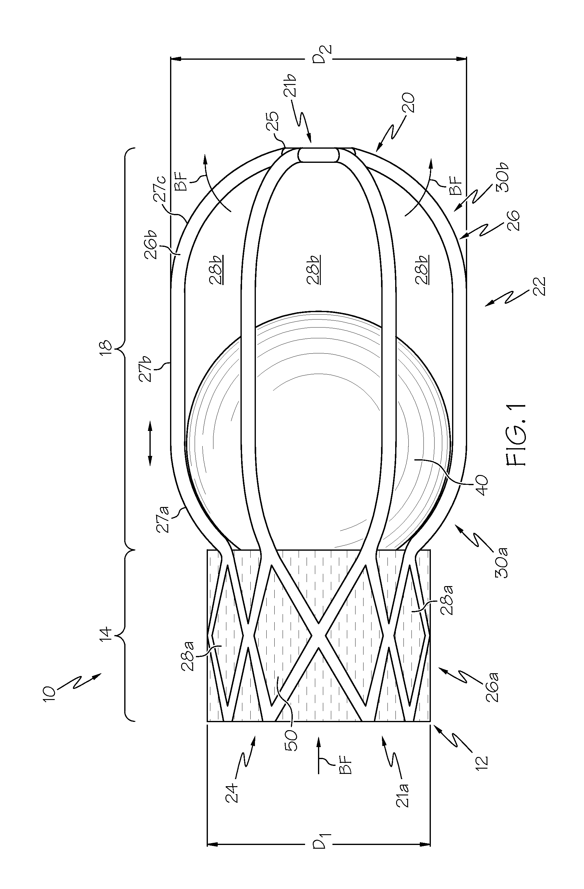 Collapsible caged-ball prosthetic  valve for transcatheter delivery and method of use