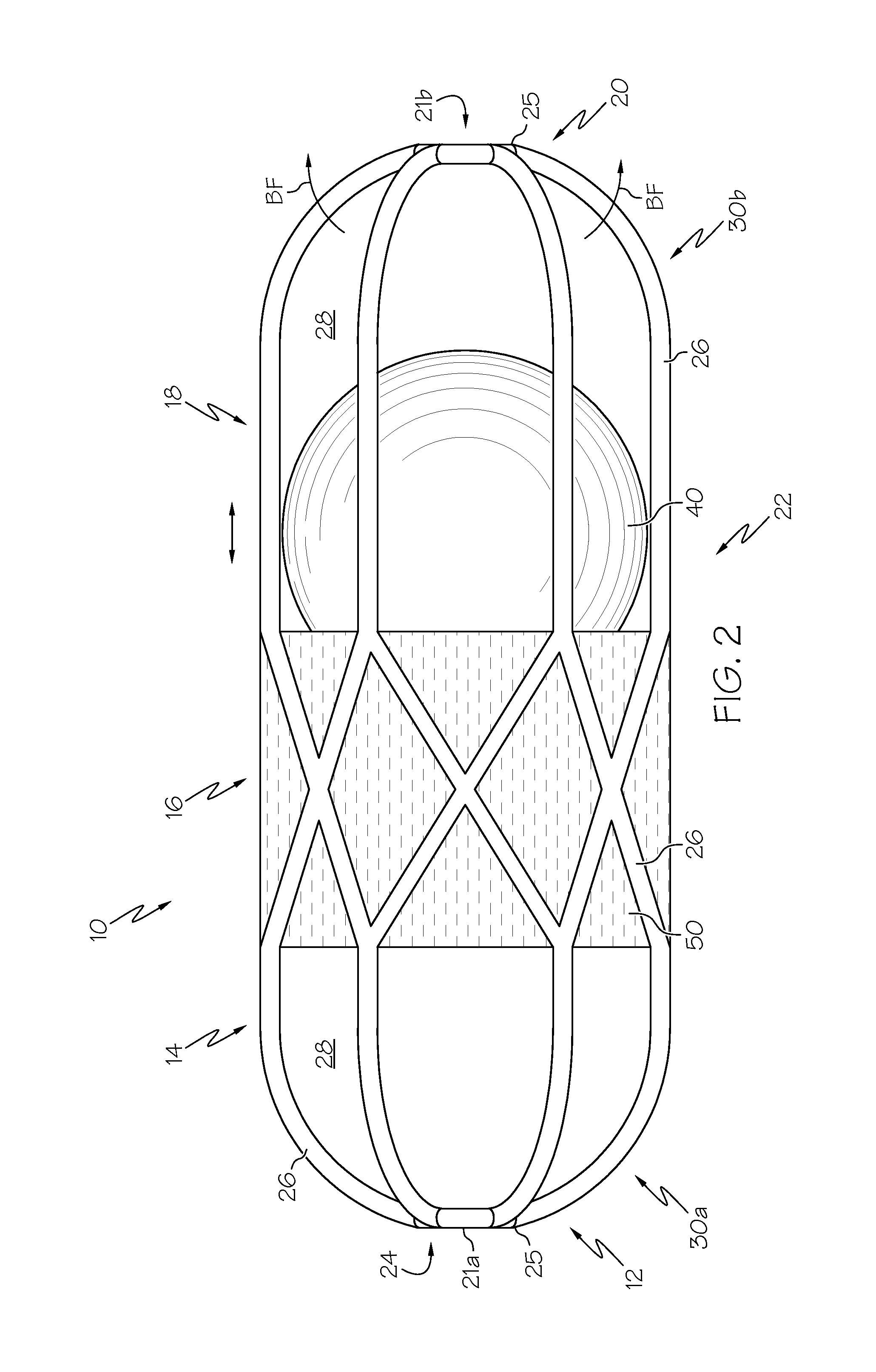 Collapsible caged-ball prosthetic  valve for transcatheter delivery and method of use