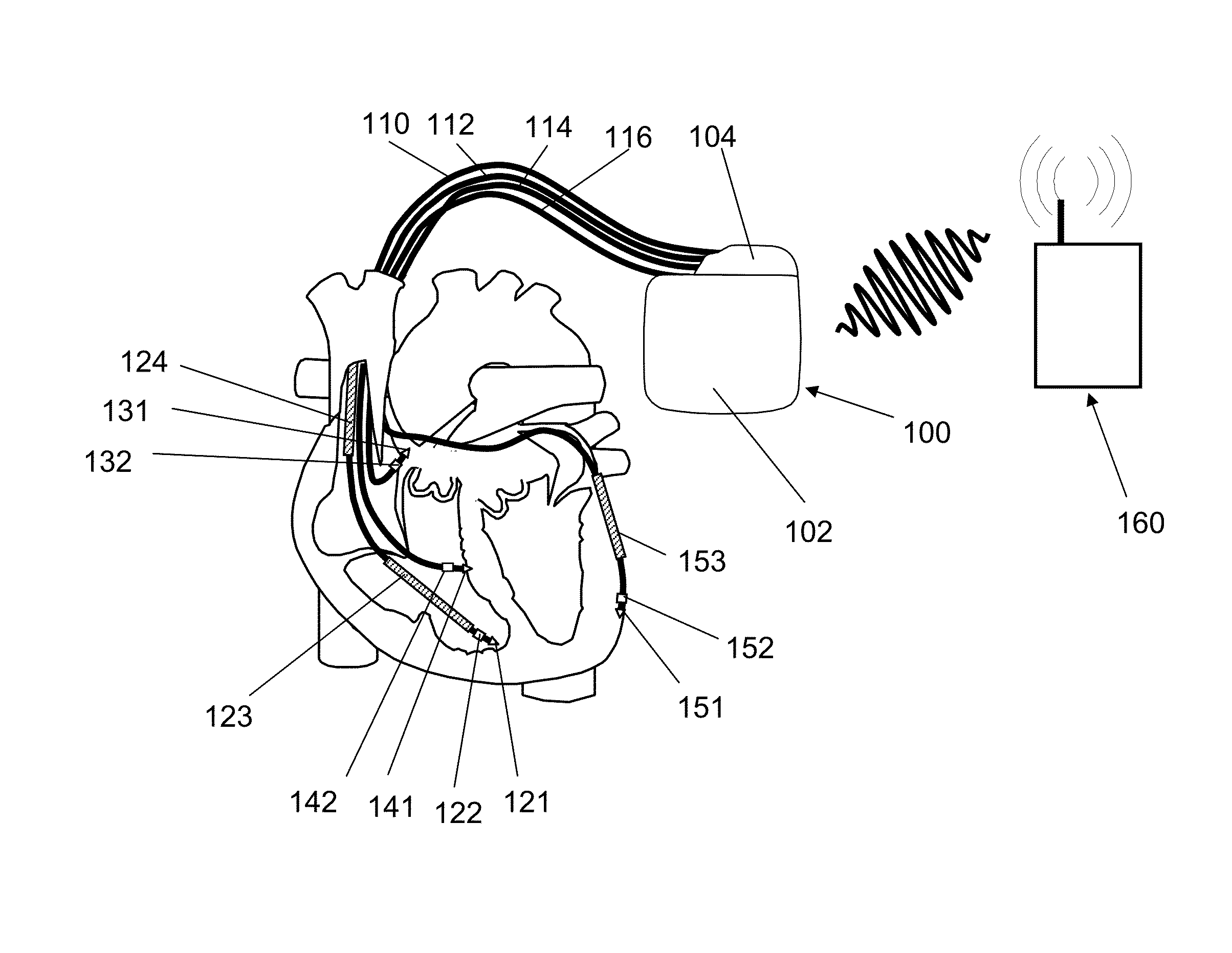 Cardiac stimulator for delivery of cardiac contractility modulation therapy