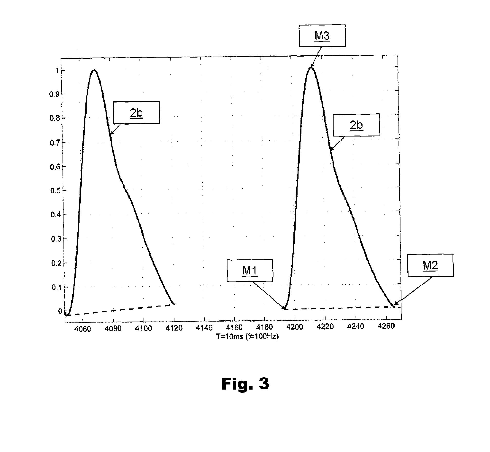 A method of determining systolic and diastolic blood pressure and the unit for this method