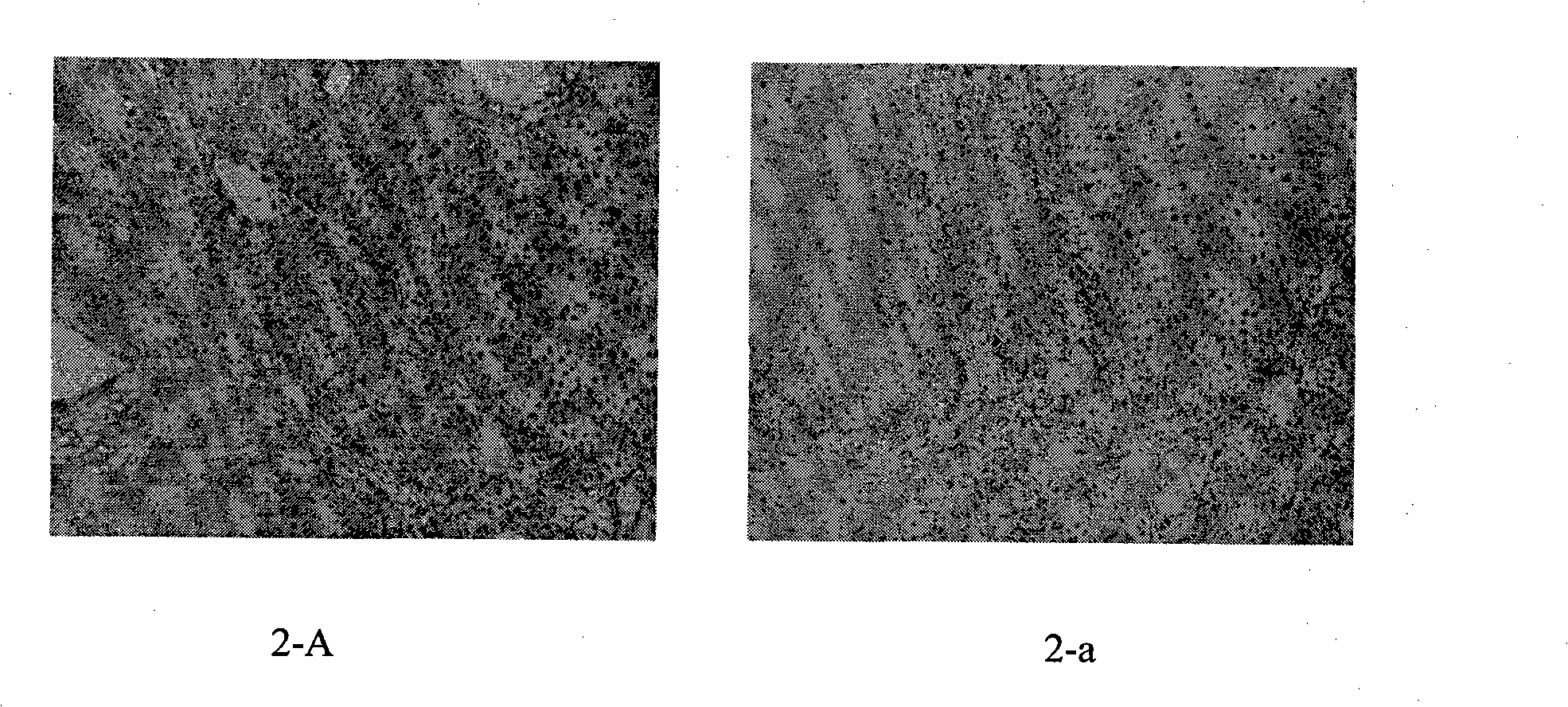 Human papilloma virus (HPV) capsid protein L1 polypeptide and preparation and application thereof