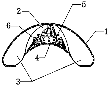 Fiber pipe for breast implant