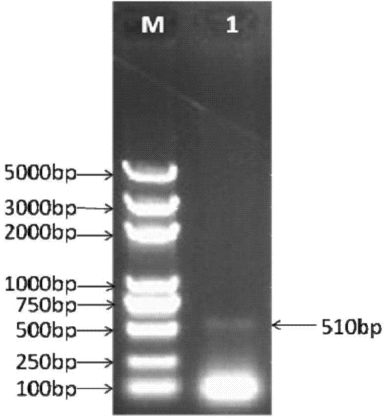 Oral recombinant yeast and application of target enteric canal DC (dentritic cell) presenting shRNA (short hairpin ribonucleic acid) mediated thereby